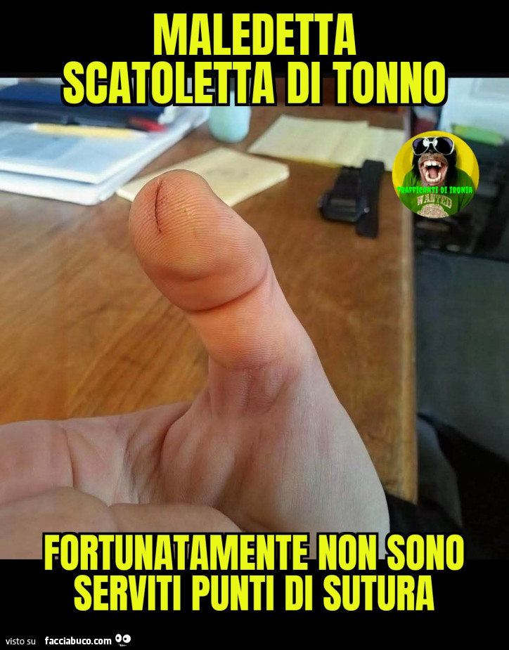 Maledetta scatoletta di tonno fortunatamente non sono serviti punti di sutura