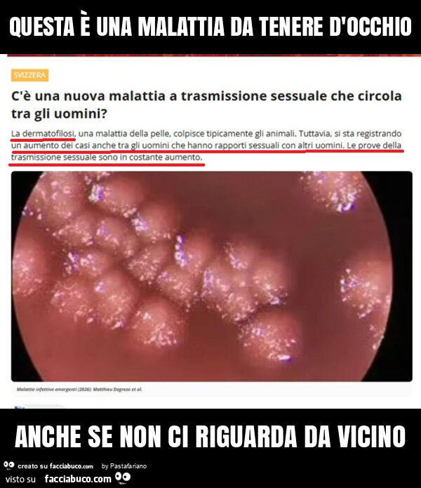 Questa è una malattia da tenere d'occhio anche se non ci riguarda da vicino