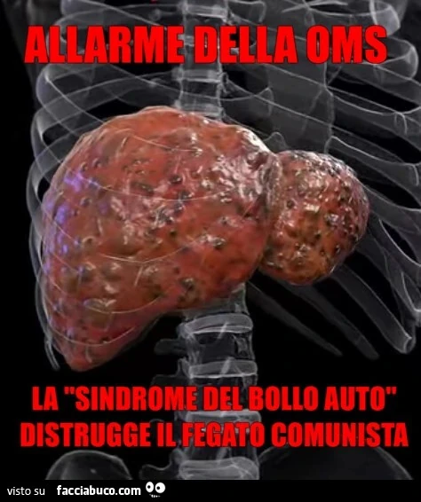 La Sindrome del bollo auto distrugge il fegato comunista