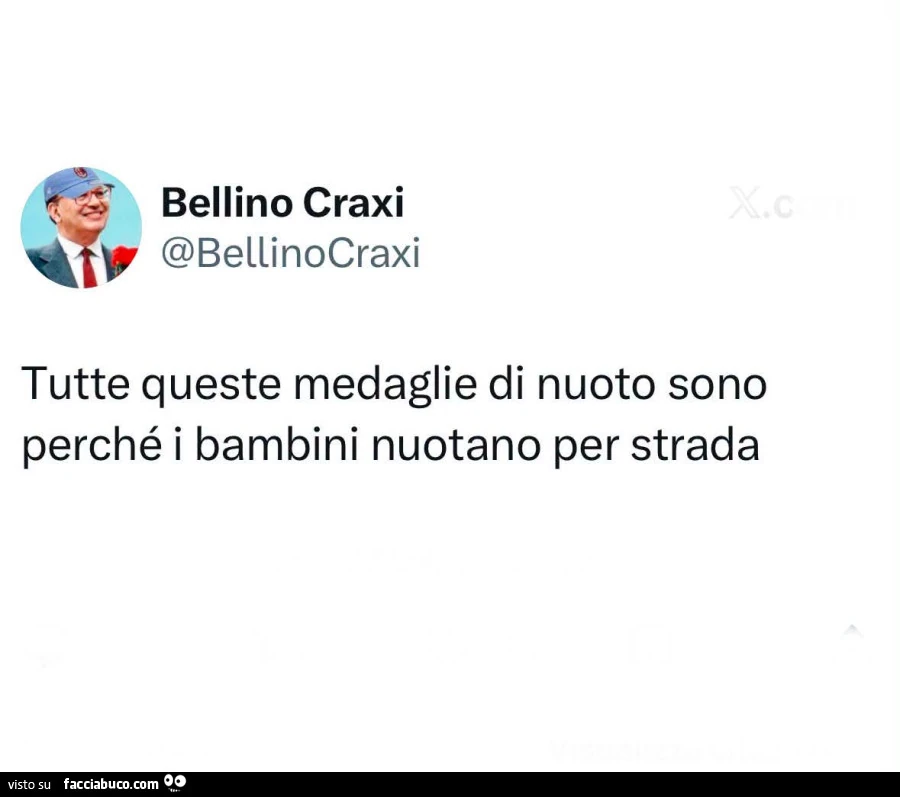 Tutte queste medaglie di nuoto sono perché i bambini nuotano per strada
