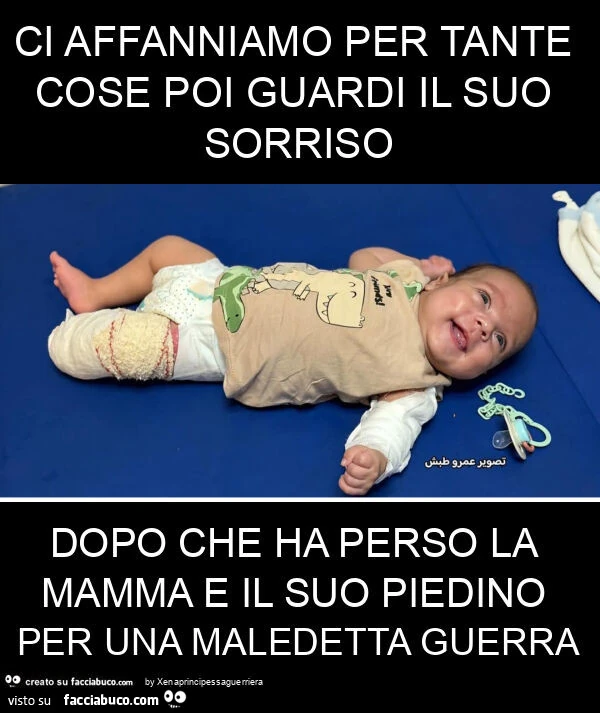 Ci affanniamo per tante cose poi guardi il suo sorriso dopo che ha perso la mamma e il suo piedino per una maledetta guerra