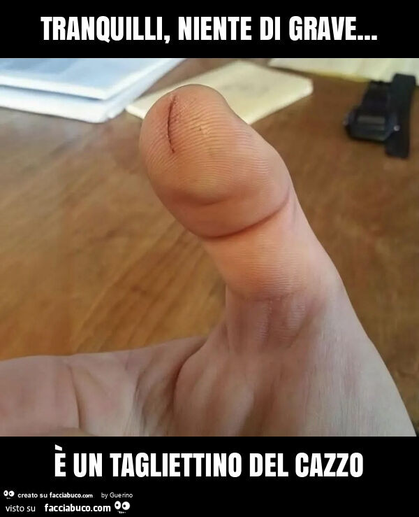 Tranquilli, niente di grave&hellip; è un tagliettino del cazzo