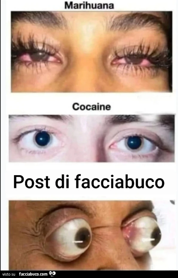 Post facciabuco